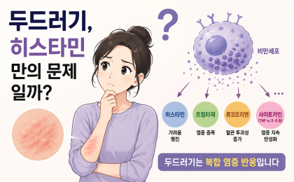 두드러기, 히스타민만의 문제일까? 비만세포 염증 반응까지 정리