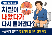 치질이 튀어나왔다가 들어간다면 수술해야 할까?