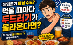 히스타민 불내성, 두드러기와 어떤 관계가 있을까?