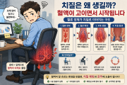 치질은 왜 생기는걸까?
